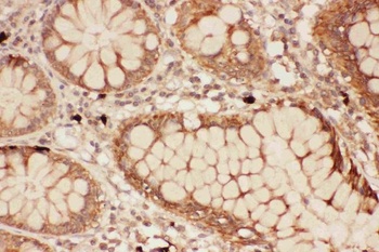 Anti-15 Lipoxygenase 1/ALOX15 Antibody