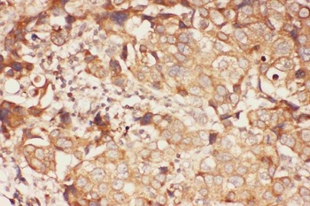 Anti-15 Lipoxygenase 1/ALOX15 Antibody