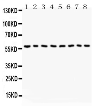 Anti-Beclin 1/BECN1 Antibody