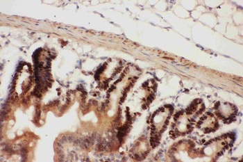 Anti-Beclin 1/BECN1 Antibody