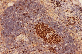 Anti-Beclin 1/BECN1 Antibody