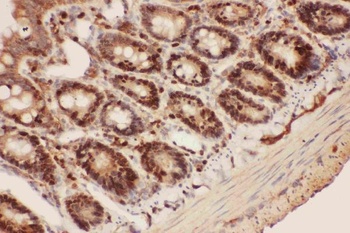 Anti-Beclin 1/BECN1 Antibody