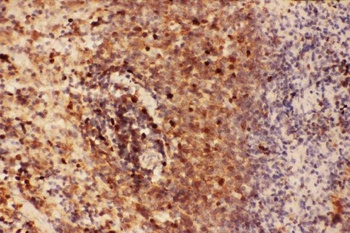 Anti-Beclin 1/BECN1 Antibody