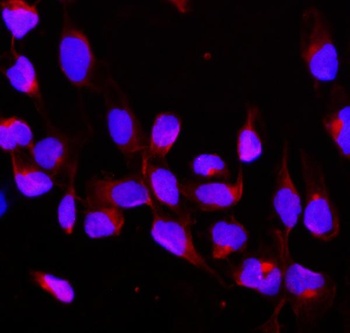 Anti-CBL Antibody