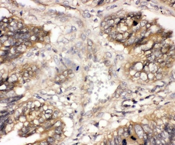 Anti-CBL Antibody