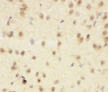 Anti-CBL Antibody