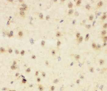 CBL Antibody