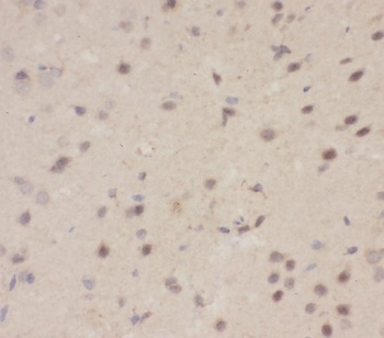 Anti-CBL Antibody
