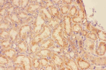 Anti-CXCR3 Antibody
