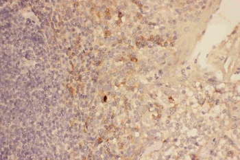 Anti-CXCR3 Antibody