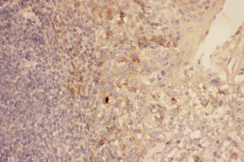 CXCR3 Antibody