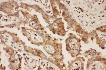 Anti-CXCR3 Antibody