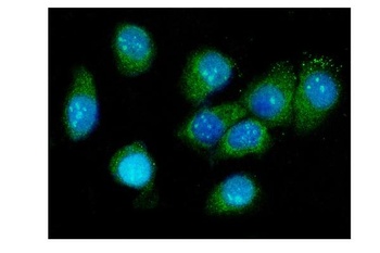 Galectin 3/LGALS3 Antibody