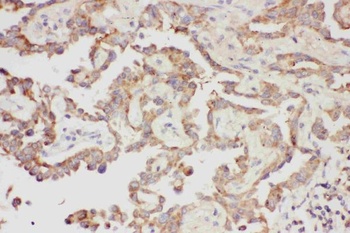 Galectin 3/LGALS3 Antibody
