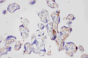 Galectin 3/LGALS3 Antibody