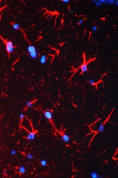 Anti-GFAP Antibody