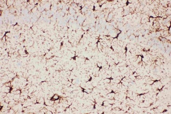 Anti-GFAP Antibody