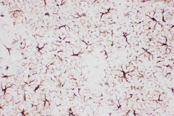 Anti-GFAP Antibody