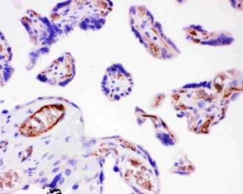 Anti-Integrin beta 1/ITGB1 Antibody