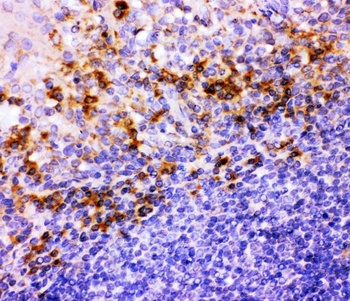 Anti-Integrin beta 1/ITGB1 Antibody