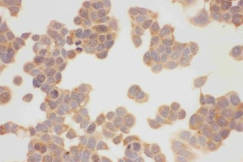 Hsp90 alpha/HSP90AA1 Antibody