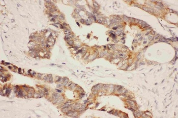 Hsp90 alpha/HSP90AA1 Antibody