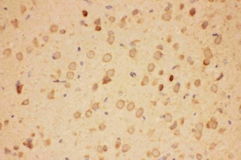 Anti-Hsp90 alpha/HSP90AA1 Antibody