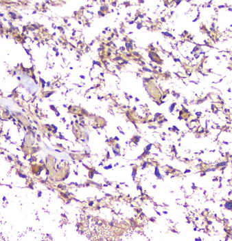 Anti-beta Amyloid/APP Antibody