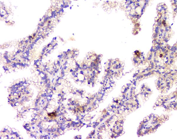 Anti-beta Amyloid/APP Antibody