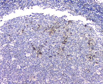 Anti-beta Amyloid/APP Antibody
