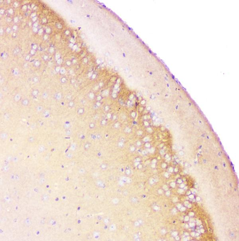 Anti-beta Amyloid/APP Antibody