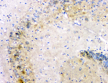 Anti-beta Amyloid/APP Antibody