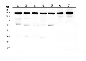 Anti-beta Amyloid/APP Antibody