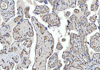 CD31/PECAM1 Antibody