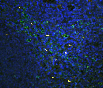 Anti-CD43/SPN Antibody