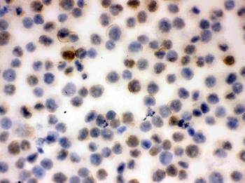 Anti-CD43/SPN Antibody
