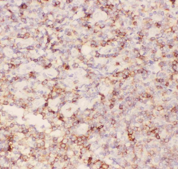 Anti-CD43/SPN Antibody