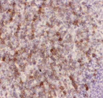 Anti-CD43/SPN Antibody