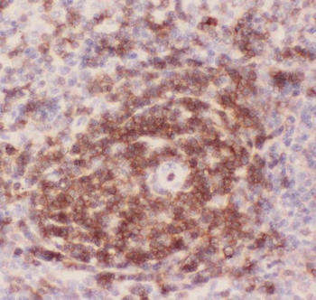 Anti-CD43/SPN Antibody