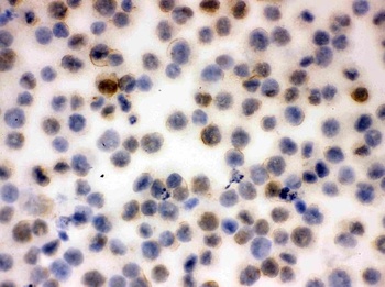 CD43/SPN Antibody