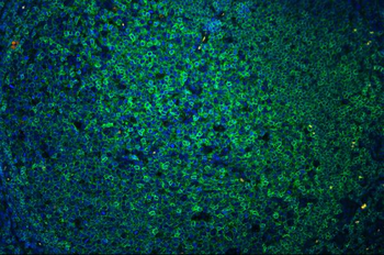 Anti-CD45/PTPRC Antibody