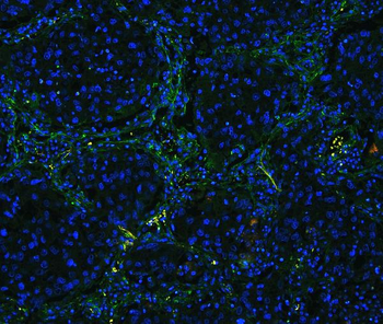 Collagen IV/COL4A1 Antibody