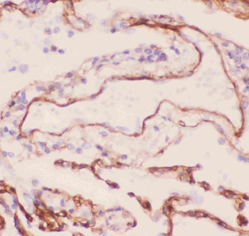 Collagen IV/COL4A1 Antibody