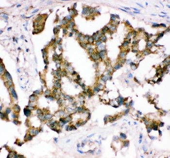 Crk p38 Rabbit Polyclonal Antibody