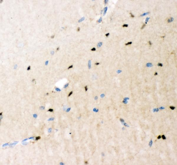 Crk p38 Rabbit Polyclonal Antibody