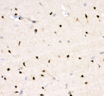 Crk p38 Rabbit Polyclonal Antibody