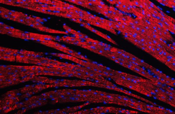 Anti-Desmin Antibody