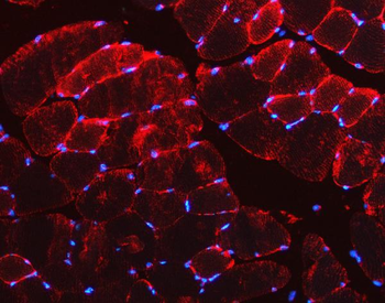 Anti-Desmin Antibody