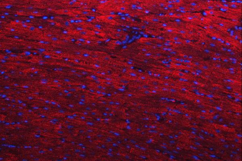 Anti-Desmin Antibody