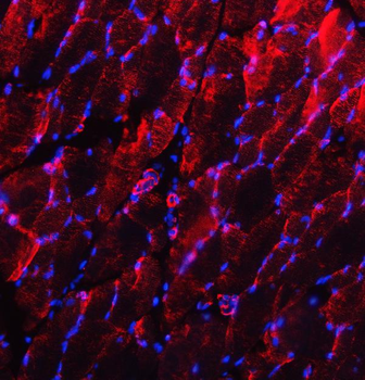 Anti-Desmin Antibody
